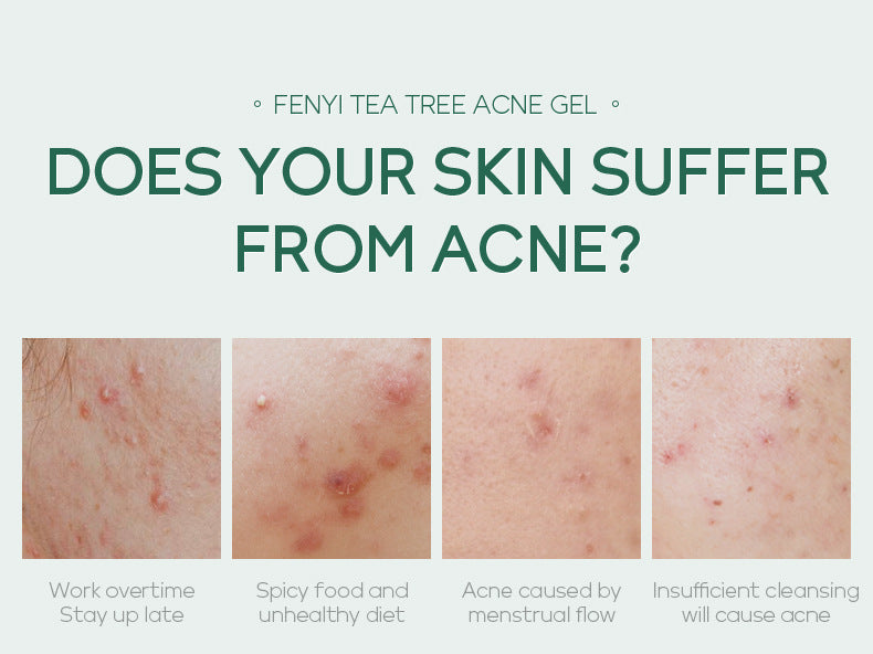 Gel Anti-Acné au Tea Tree – Soin Ciblé Réparateur (20g)