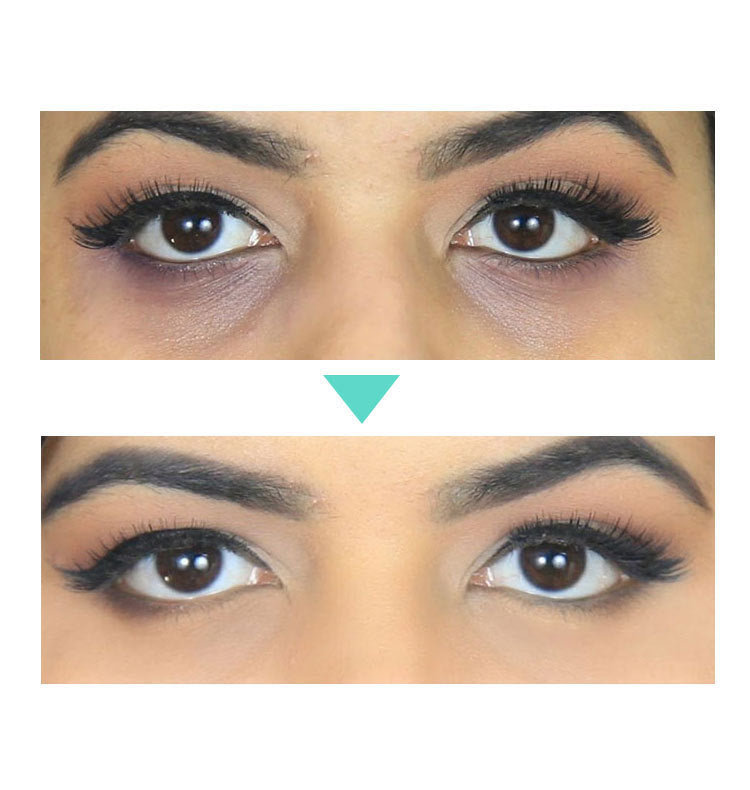 Crème Contour des Yeux au Rétinol 2,5 % – Anti-Cernes & Anti-Ridules