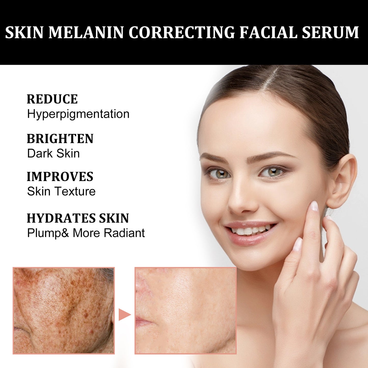 Sérum Correcteur de Mélanine – EELHOE (30ml)