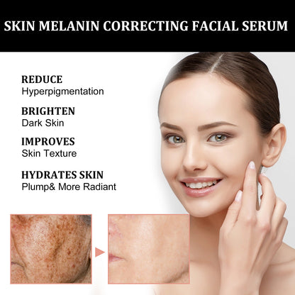 Sérum Correcteur de Mélanine – EELHOE (30ml)
