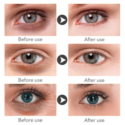 Crème Contour des Yeux au Rétinol 2,5 % – Anti-Cernes & Anti-Ridules