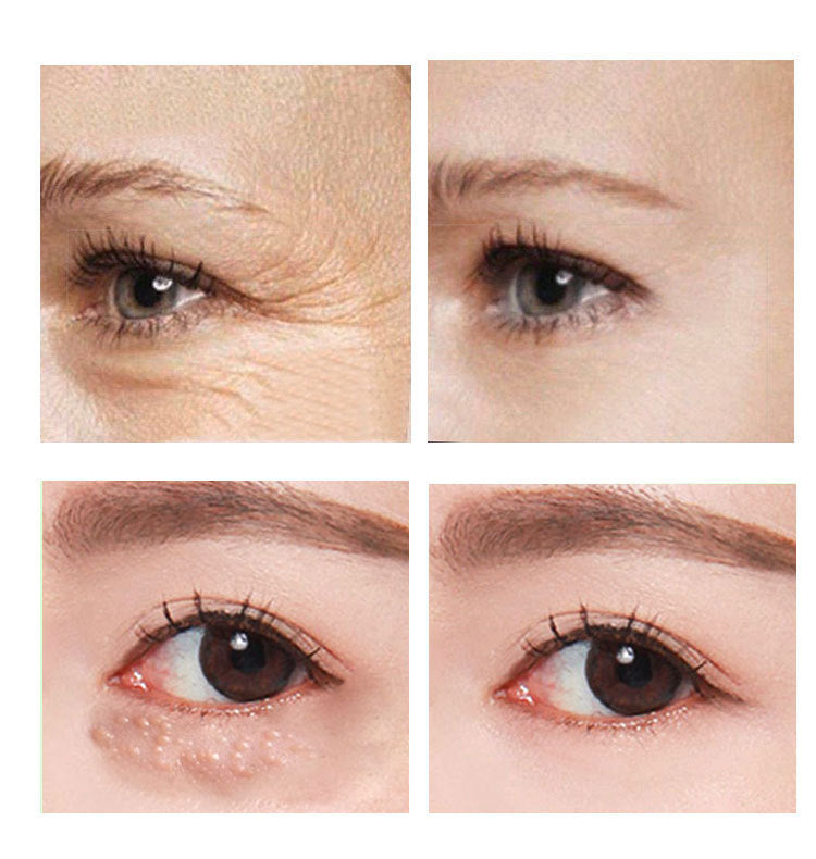 Crème Contour des Yeux au Rétinol 2,5 % – Anti-Cernes & Anti-Ridules