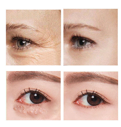 Crème Contour des Yeux au Rétinol 2,5 % – Anti-Cernes & Anti-Ridules